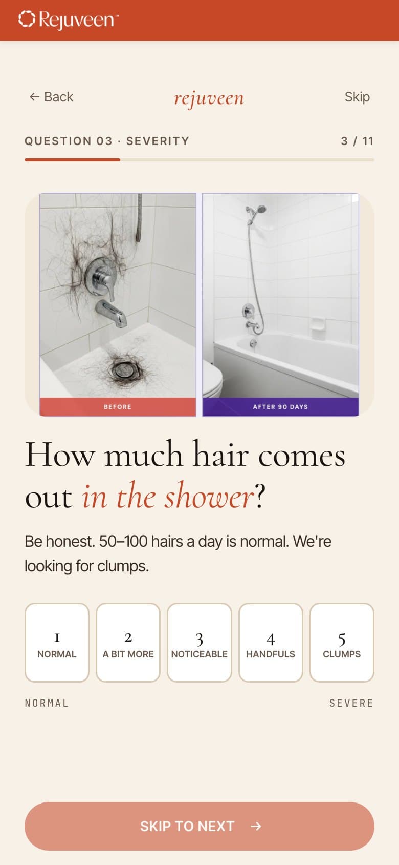 Q3 — Shower Severity Scale (Normal → Clumps)