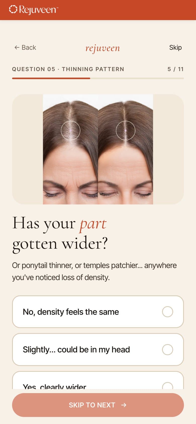 Q5 — Has Your Part Gotten Wider?