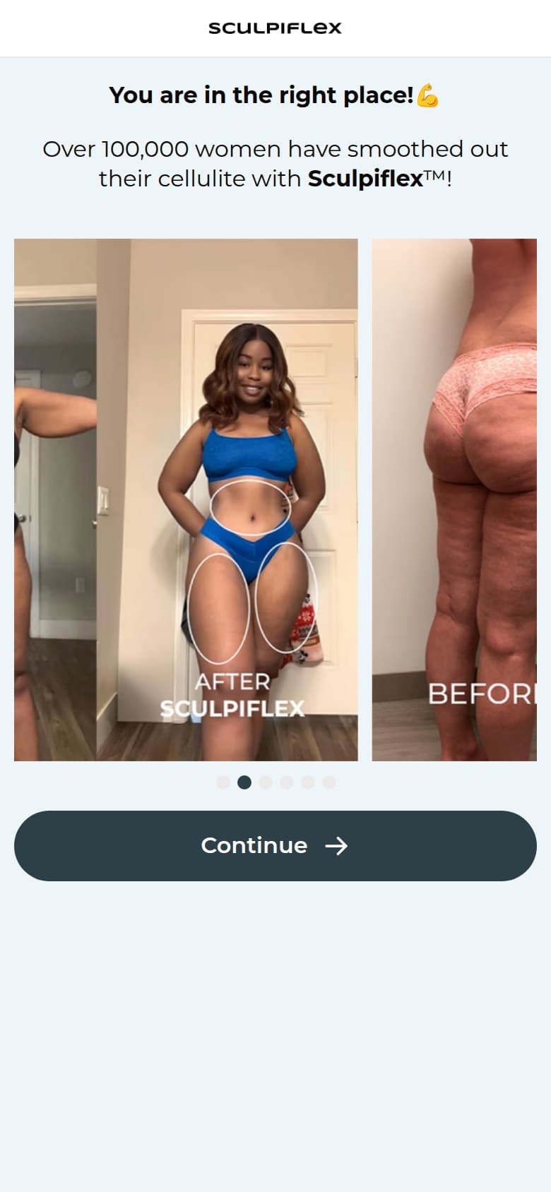 Interstitial — Right Place + Before/After Carousel